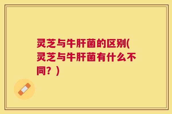 灵芝与牛菌的区别(灵芝与牛菌有什么不同?) 灵芝与牛菌的区别(灵芝与牛菌有什么不同?)